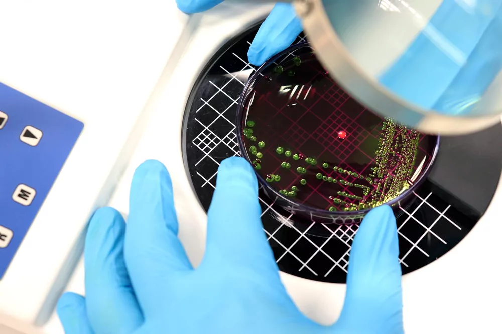 Bacterial count in next-generation probiotics: AFU technology